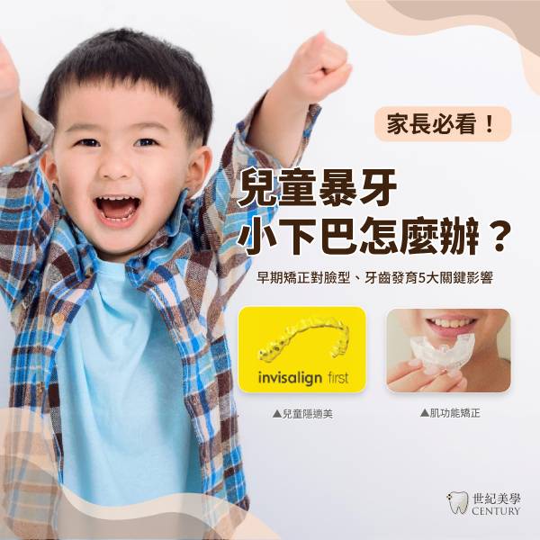 家長必看！兒童暴牙、小下巴怎麼辦？兒童早期矯正對臉型、牙齒發育5大關鍵好處
